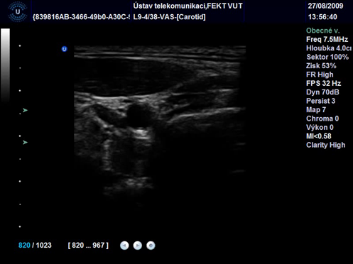 Obr. 1 Zdrojový ultrazvukový obraz.